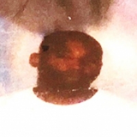 Tommyclarkgentrypic 1524164454